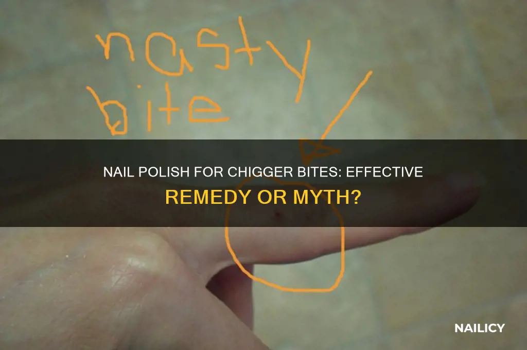 is nail polish good for chigger bites