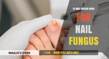 Nail Polish and Fungus: Effective Treatment or Harmful Myth?