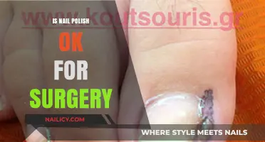 Nail Polish and Surgery: What You Need to Know Beforehand
