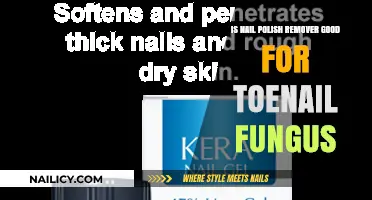 Toenail Fungus: Can Nail Polish Remover Help?