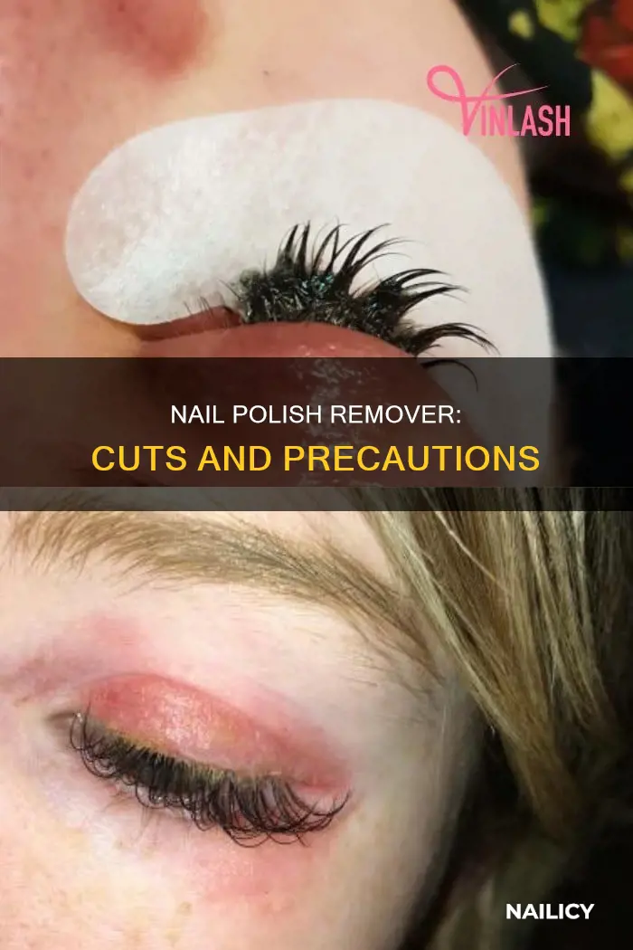 is nail polish remover in a cut bad