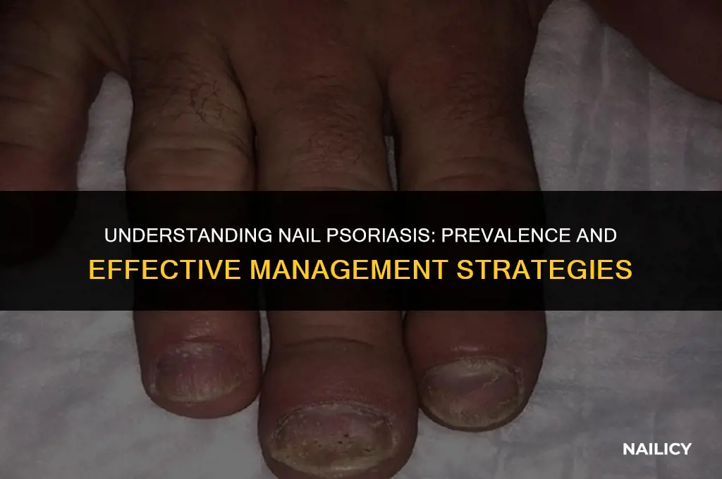 is nail psoriasis common