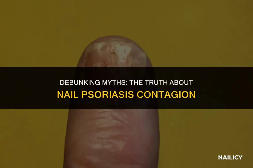 is nail psoriasis contagious