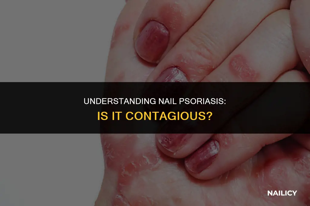 is nail psoriasis is communicable
