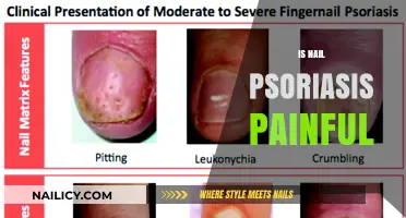 Understanding Nail Psoriasis: Causes, Symptoms, and Effective Treatments