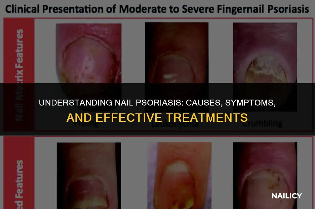 is nail psoriasis painful