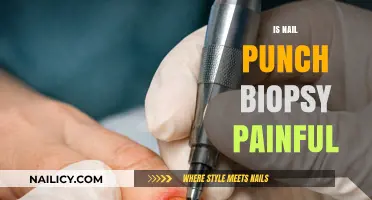 Understanding Nail Punch Biopsies: What to Expect and Is It Painful?