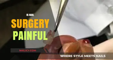 Exploring the Myths and Facts: Is Nail Surgery Really Painful?