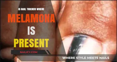 Does Melanoma Cause Thicker Nails? Uncovering the Link and Symptoms