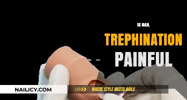 Exploring the Pain Factor: Nail Trephination Procedure Insights