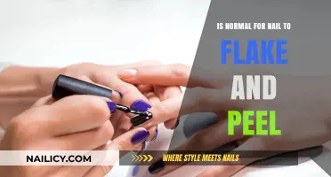 Is It Normal for Nails to Flake and Peel? Causes and Solutions