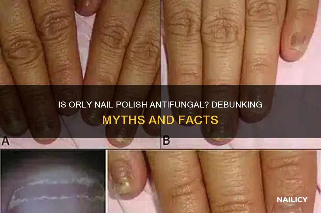 is orly nail polish antifungal