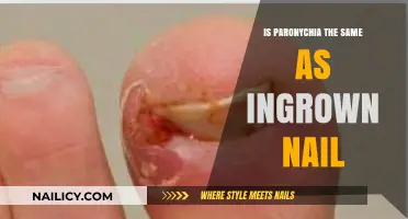 Paronychia vs. Ingrown Nail: Understanding the Differences and Similarities