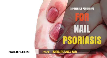 Peelable Polish and Nail Psoriasis: Safe or Harmful Choice?