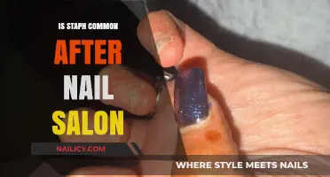 Staph Infections After Nail Salon Visits: Common Risks and Prevention Tips
