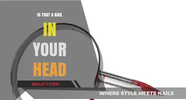 Is That a Nail in Your Head? Unraveling the Bizarre Truth