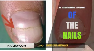 Understanding Onycholysis: Causes and Treatments for Soft, Separated Nails