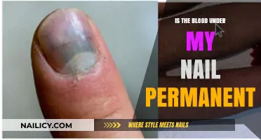 Is Blood Under My Nail Permanent? Healing, Stains, and Solutions