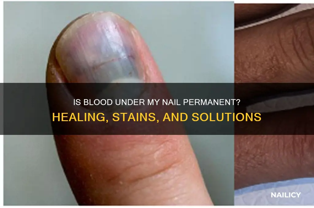 is the blood under my nail permanent
