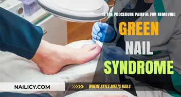 Green Nail Syndrome: Is Removal Painful?