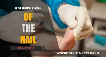 Surgical Nail Removal: What to Expect
