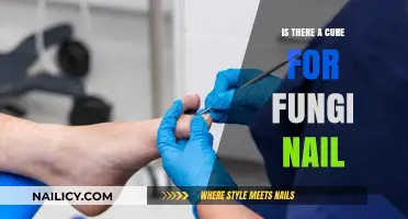 Can Fungal Nail Infections Be Cured? Effective Treatments and Solutions