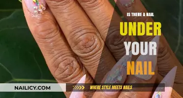 Hidden Nail Under Your Nail: Causes, Symptoms, and Treatment Options