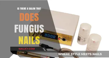 Where to Find Salons That Treat Fungus Nails Effectively