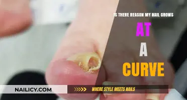 Why Do Nails Curve as They Grow?