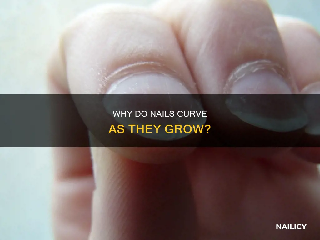 is there reason my nail grows at a curve