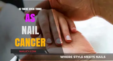 Nail Cancer: Myth or Reality? Uncovering the Truth About Nail Health