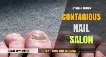 Toenail Fungus Contagious? Nail Salon Risks and Prevention Tips