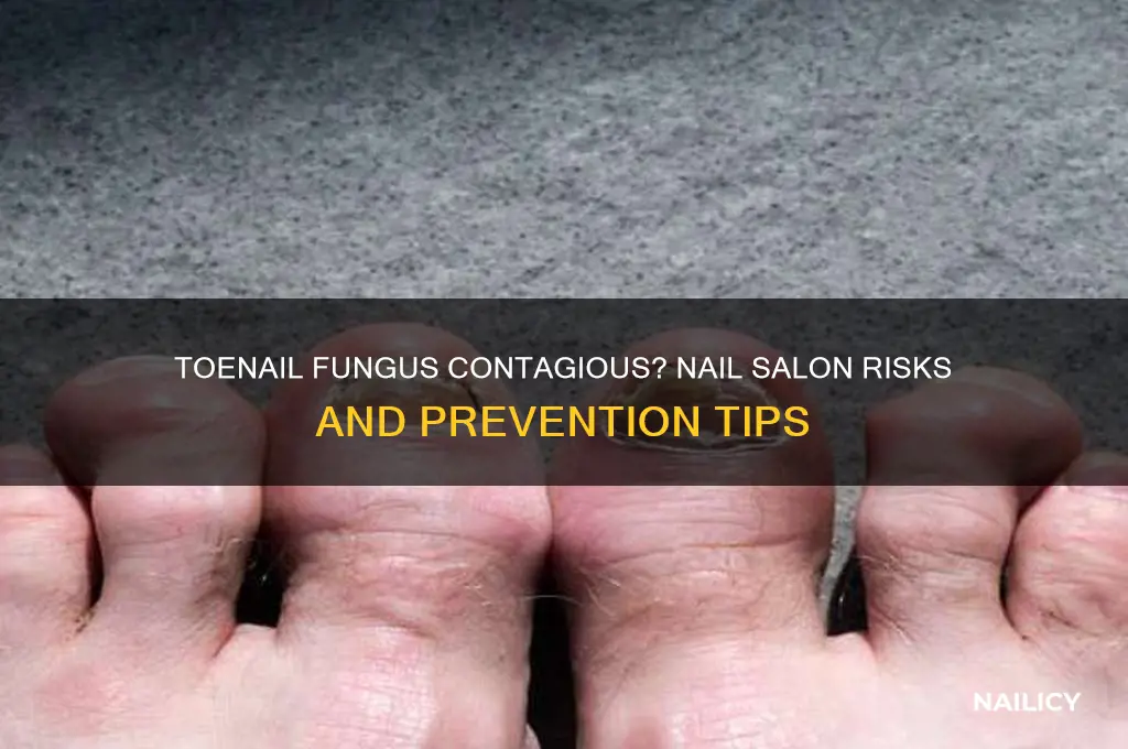 is toenail fungus contagious nail salon
