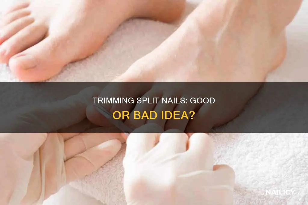 is trimming a split nail a bad jdea