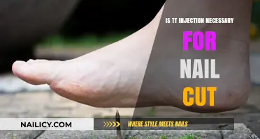 TT Injection: Necessary for Nail Cut?