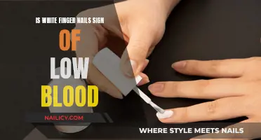 White Fingernails: A Sign of Low Blood?