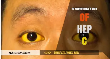 Yellow Nails and Hepatitis C: Uncovering the Hidden Connection