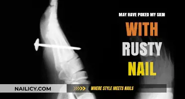 Rusty Nail Poke: Risks, Symptoms, and Immediate Steps to Take