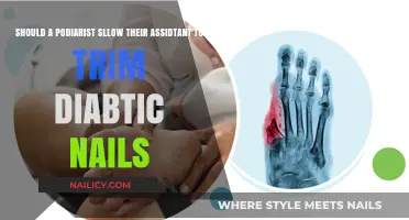 Podiatrists: When to Delegate Diabetic Nail Trimming
