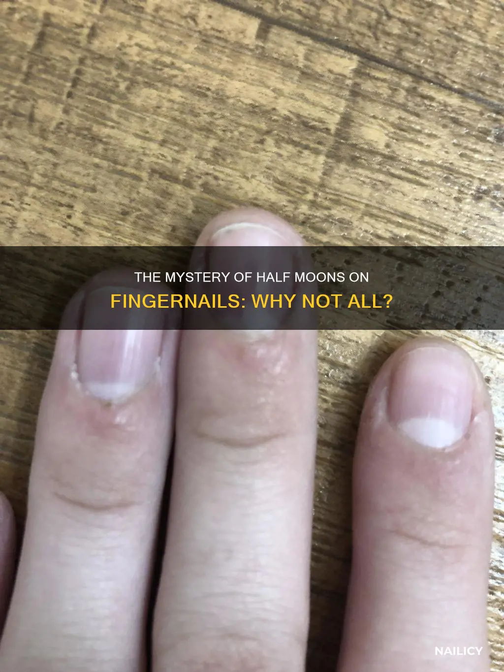 should all finger nails have half moons