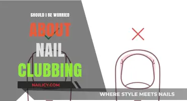 Nail Clubbing Concerns: When to Worry and Seek Medical Advice