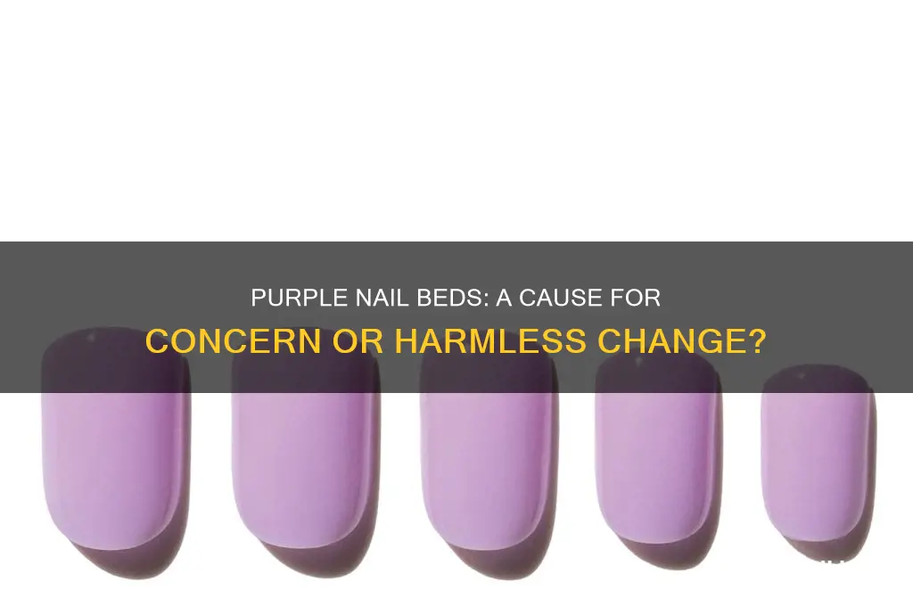 should i be worried about purple nail beds