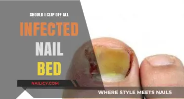 Should You Remove Infected Nail Beds? Risks and Recovery Tips
