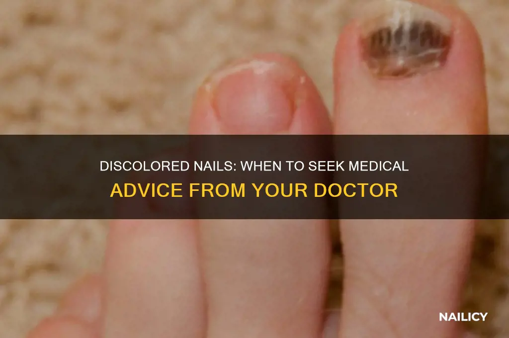 should i contact my doctor about discolored nails