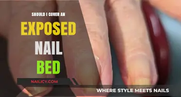 Should You Cover an Exposed Nail Bed? Essential Tips and Advice