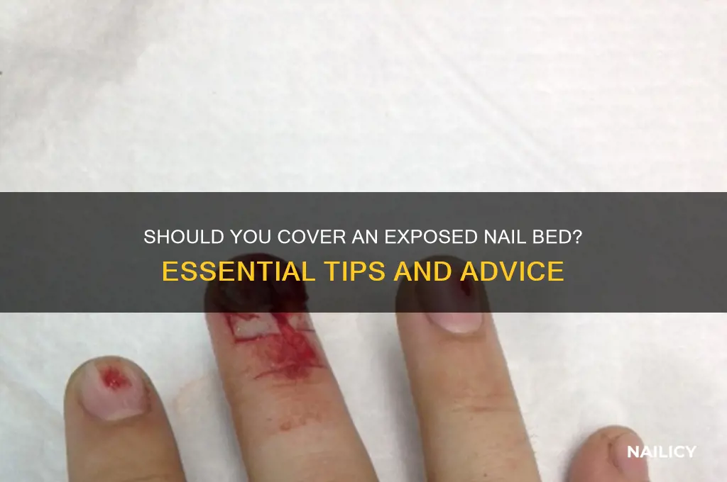 should i cover an exposed nail bed