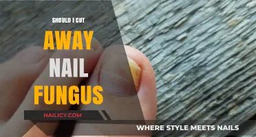 Nail Fungus: To Cut or Not to Cut?