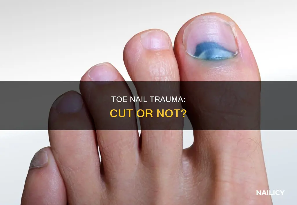 should i cut off a gaping toe nail