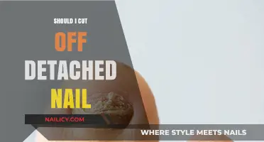 When to Cut a Detached Nail