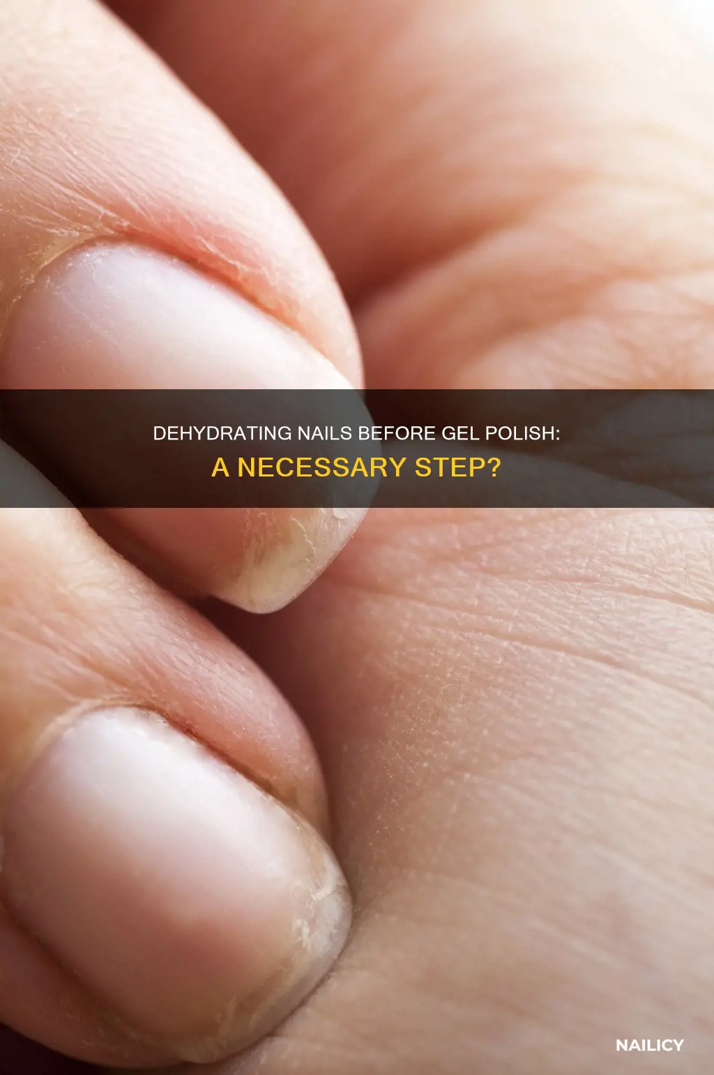 should i dehydrate nail before gel polish